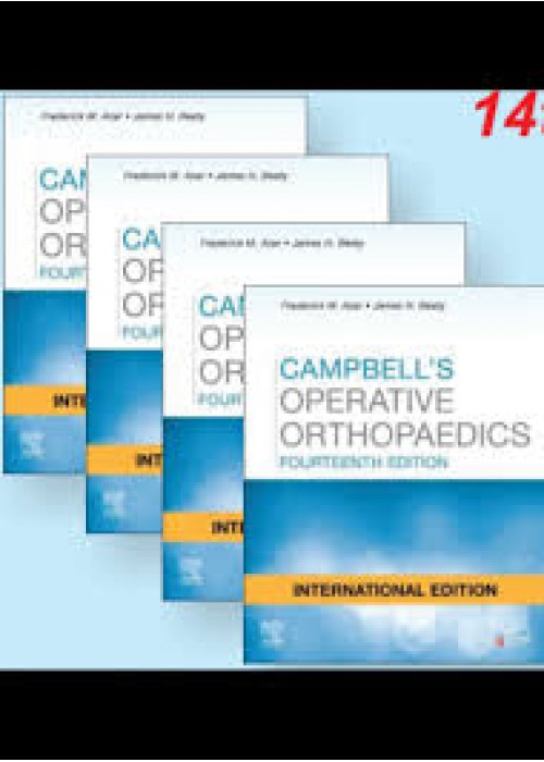 Campbells Operative Orthopaedics